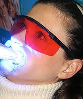 Load image into Gallery viewer, Teeth Whitening Machine REMOTE
